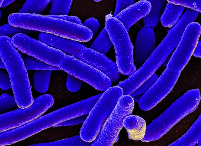 E. coli gehienetan emakumezkoetan zistitisaren garapena eragiten du